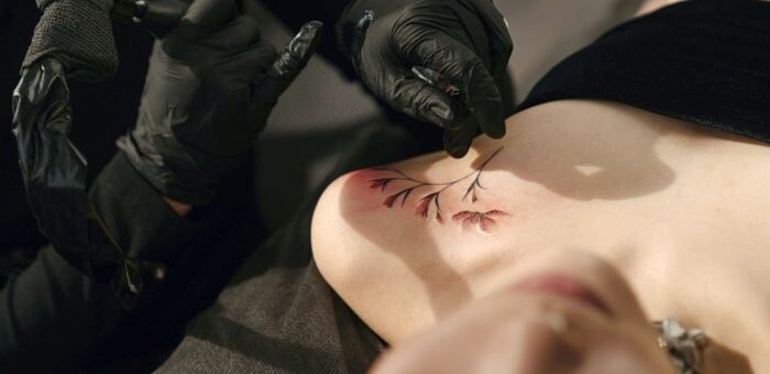 Jak działa laserowe usuwanie tatuażu?